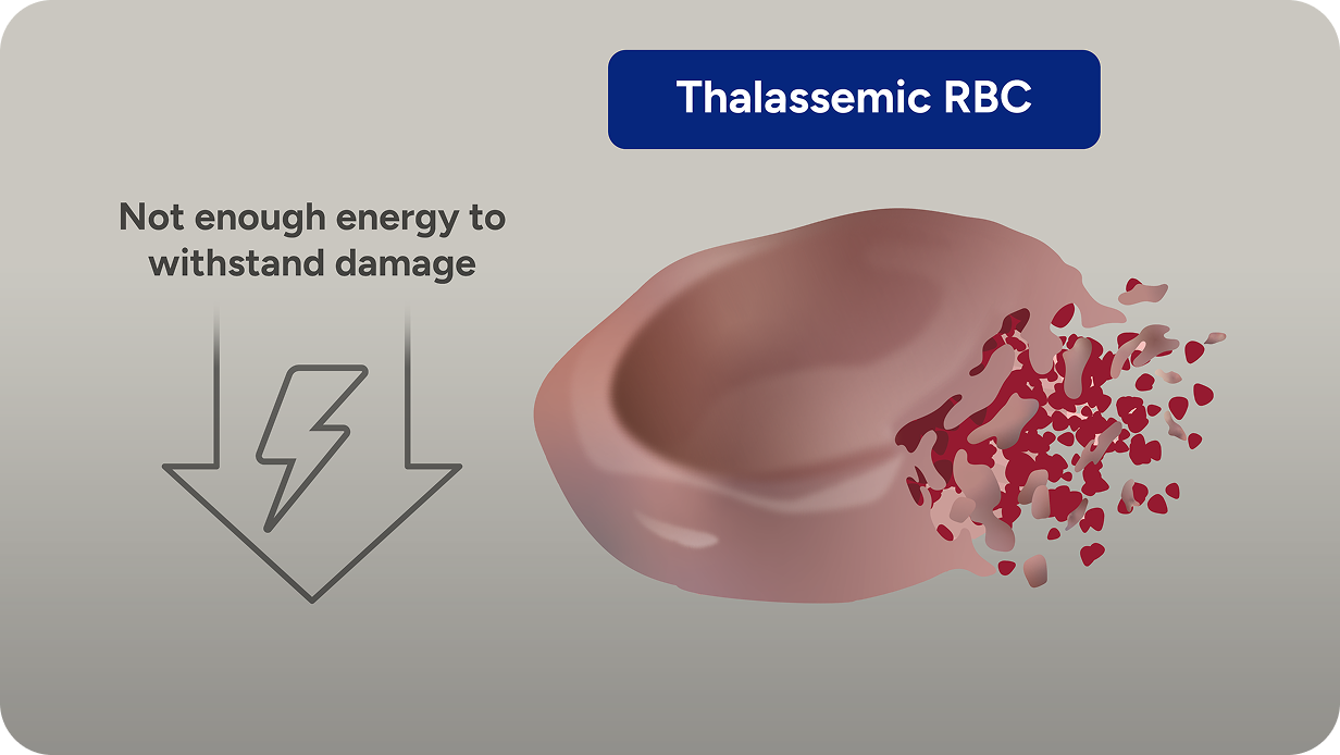 Image showing single thalassemic RBC breaking down early